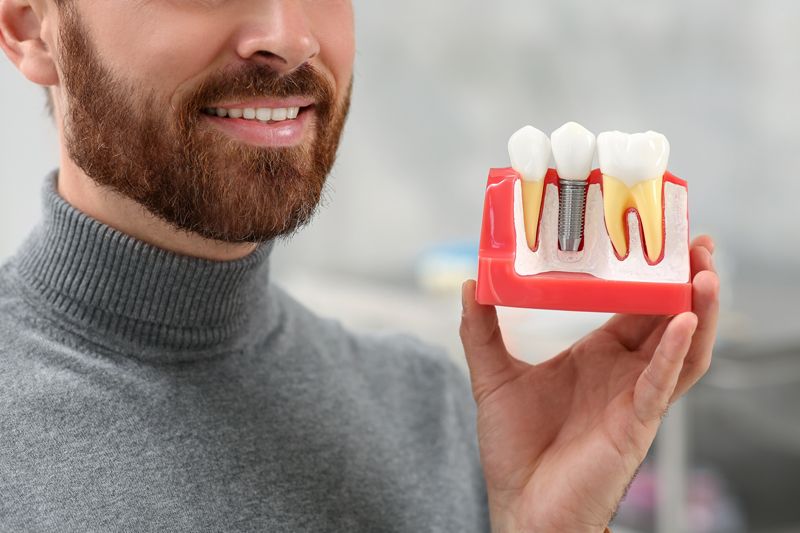 Man holding educational model of dental implant on blurred background, closeup. .